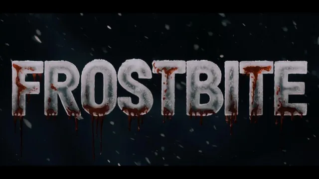 Frostbite